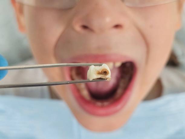 Best Emergency Dental Care for Broken or Chipped Teeth in Tonopah, NV
